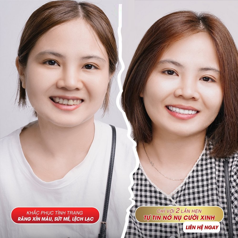 nieng rang 033