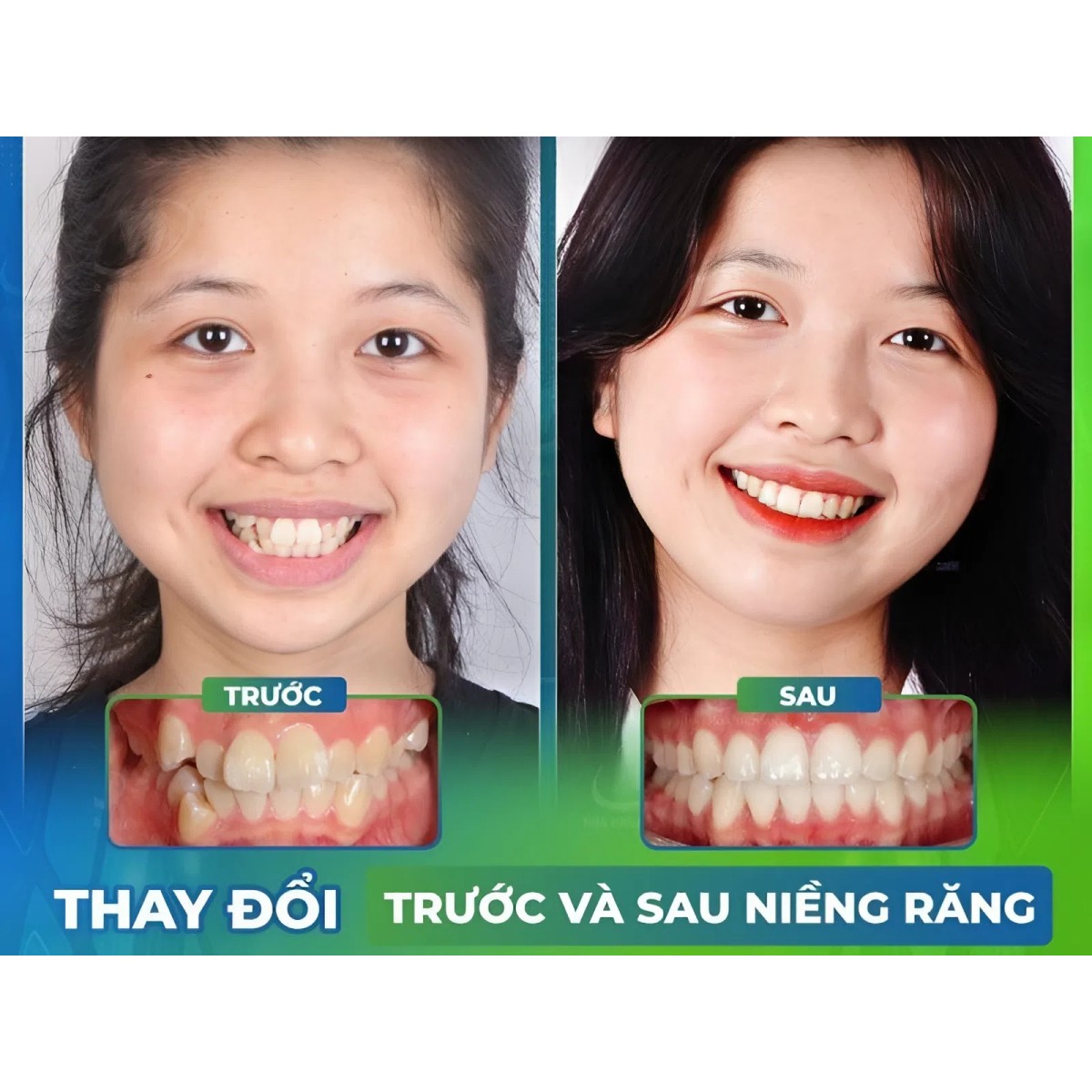 nieng rang 1